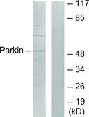 Anti-Parkin antibody produced in rabbit affinity isolated antibody