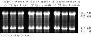RNAlater&#174; Stabilize and protect RNA with immediate RNase inactivation