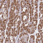 Anti-MPC2 antibody produced in rabbit Prestige Antibodies&#174; Powered by Atlas Antibodies, affinity isolated antibody, buffered aqueous glycerol solution