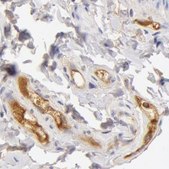 Anti-TF antibody produced in rabbit Ab1, Prestige Antibodies&#174; Powered by Atlas Antibodies, affinity isolated antibody, buffered aqueous glycerol solution