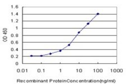 Monoclonal Anti-CPT2 antibody produced in mouse clone 1G7, purified immunoglobulin, buffered aqueous solution
