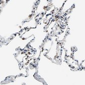Anti-NLRP3 antibody produced in rabbit Prestige Antibodies&#174; Powered by Atlas Antibodies, affinity isolated antibody, buffered aqueous glycerol solution