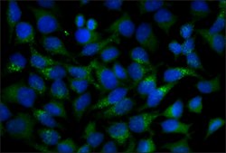 Anti-Cathepsin D antibody, Mouse monoclonal clone CTD-19, purified from hybridoma cell culture