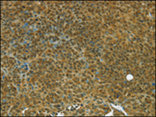 Anti-TGM7 affinity isolated antibody