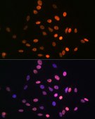 Anti-HMGA1 antibody produced in rabbit