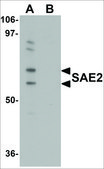 Anti-SAE2 antibody produced in rabbit affinity isolated antibody, buffered aqueous solution