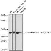 Anti-&#945;-Smooth Muscle Actin (ACTA2) Antibody, clone 2V4L9, Rabbit Monoclonal