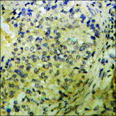 Anti-phospho-PAK2 (pSer141) antibody produced in rabbit affinity isolated antibody