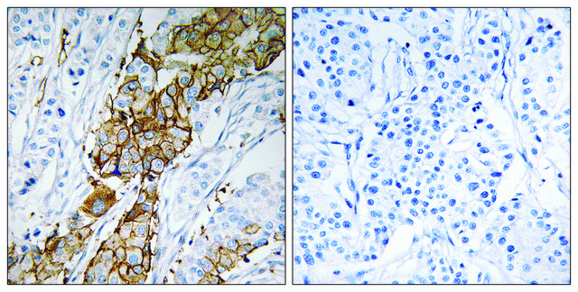 Anti-USP32 antibody produced in rabbit affinity isolated antibody