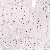 Monoclonal Anti-Foxo3 Antibody Produced In Mouse Prestige Antibodies&#174; Powered by Atlas Antibodies, clone CL13603, affinity isolated antibody, buffered aqueous glycerol solution