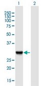 Anti-SLC25A5 antibody produced in mouse IgG fraction of antiserum, buffered aqueous solution