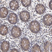 Anti-ESYT2 antibody produced in rabbit Prestige Antibodies&#174; Powered by Atlas Antibodies, affinity isolated antibody, buffered aqueous glycerol solution