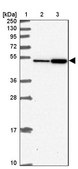 Anti-FBXL20 antibody produced in rabbit Prestige Antibodies&#174; Powered by Atlas Antibodies, affinity isolated antibody, buffered aqueous glycerol solution