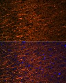 Anti-Alpha Internexin Antibody, clone 5E5Z3, Rabbit Monoclonal