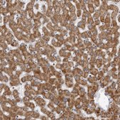 Anti-CPT2 antibody produced in rabbit Prestige Antibodies&#174; Powered by Atlas Antibodies, affinity isolated antibody, buffered aqueous glycerol solution, ab2