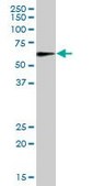 Anti-MAOA antibody produced in mouse IgG fraction of antiserum, buffered aqueous solution