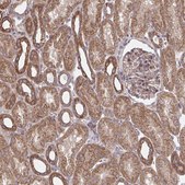 Anti-ITPR2 antibody produced in rabbit Prestige Antibodies&#174; Powered by Atlas Antibodies, affinity isolated antibody, buffered aqueous glycerol solution