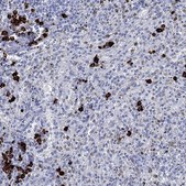 Anti-P2RY6 antibody produced in rabbit Prestige Antibodies® Powered by Atlas Antibodies, affinity isolated antibody, buffered aqueous glycerol solution