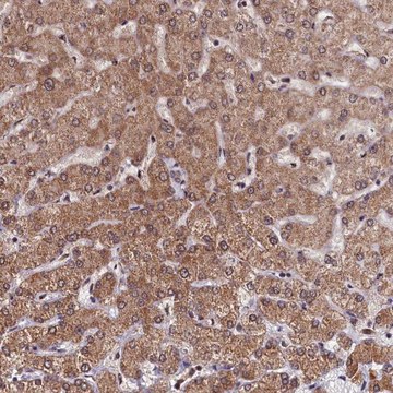 Anti-CLPX antibody produced in rabbit Prestige Antibodies&#174; Powered by Atlas Antibodies, affinity isolated antibody, buffered aqueous glycerol solution