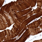 Anti-SYNPO2 antibody produced in rabbit Prestige Antibodies&#174; Powered by Atlas Antibodies, affinity isolated antibody, buffered aqueous glycerol solution