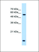 Anti-P4HB (AB2) antibody produced in rabbit affinity isolated antibody