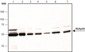 Anti-RbAp46, C-terminal antibody produced in rabbit affinity isolated antibody, buffered aqueous solution