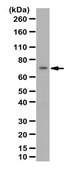 Anti-Mu Opioid Receptor Antibody from rabbit, purified by affinity chromatography