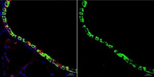 Anti-Uteroglobin serum, from goat