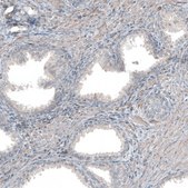Anti-COL1A1 antibody produced in rabbit Prestige Antibodies® Powered by Atlas Antibodies, affinity isolated antibody, buffered aqueous glycerol solution