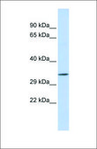 Anti-TEX264 antibody produced in rabbit affinity isolated antibody