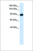 Anti-RAD54B (ab3) antibody produced in rabbit affinity isolated antibody