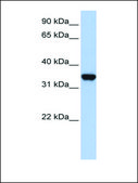 Anti-LDHA affinity isolated antibody