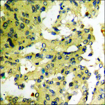 Anti-phospho-MAP3K1 (pThr1402) antibody produced in rabbit affinity isolated antibody