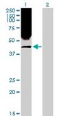 Anti-RRM2 antibody produced in rabbit purified immunoglobulin, buffered aqueous solution