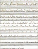 High Pure Plasmid Isolation Kit Roche, pkg of 50 purifications (11754777001), pkg of 250 purifications (11754785001)