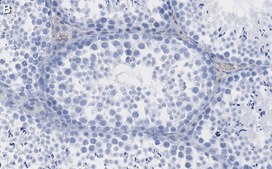 Anti-IDH1 Antibody, clone 1M9 ZooMAb® Rabbit Monoclonal recombinant, expressed in HEK 293 cells