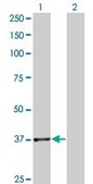 Monoclonal Anti-PLA2G4B antibody produced in mouse clone 1G5, purified immunoglobulin, buffered aqueous solution
