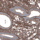 Anti-COL1A1 antibody produced in rabbit Prestige Antibodies® Powered by Atlas Antibodies, affinity isolated antibody, buffered aqueous glycerol solution