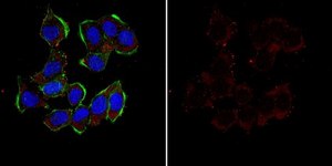 Anti-Cofilin-1 Antibody from rabbit, purified by affinity chromatography