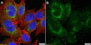 Anti-PDH kinase 1 Antibody, clone 1C7-H1 ZooMAb&#174; Rabbit Monoclonal recombinant, expressed in HEK 293 cells
