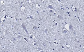 Anti-JNK2 Antibody, clone 1F16 ZooMAb® Rabbit Monoclonal recombinant, expressed in HEK 293 cells