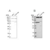 Anti-GOLGA2 antibody produced in rabbit Prestige Antibodies&#174; Powered by Atlas Antibodies, affinity isolated antibody, buffered aqueous glycerol solution, Ab2