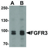 Anti-FGFR3 antibody produced in rabbit affinity isolated antibody