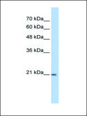 Anti-PTGDS antibody produced in rabbit affinity isolated antibody
