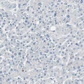 Anti-DLG4 antibody produced in rabbit Prestige Antibodies&#174; Powered by Atlas Antibodies, affinity isolated antibody, buffered aqueous glycerol solution