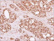 Anti-CS antibody produced in rabbit affinity isolated antibody, buffered aqueous solution