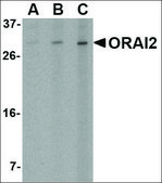 Anti-ORAI2 antibody produced in rabbit affinity isolated antibody, buffered aqueous solution