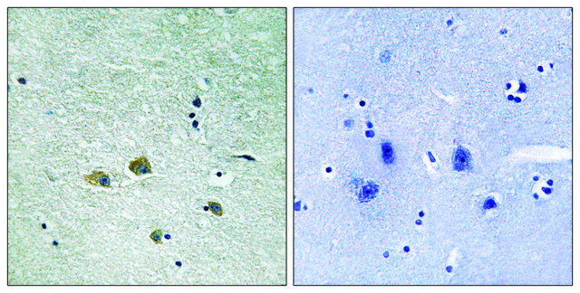 Anti-PAK1 antibody produced in rabbit affinity isolated antibody