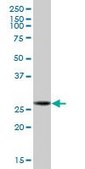 Anti-GCLM antibody produced in mouse purified immunoglobulin, buffered aqueous solution