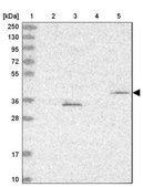 Anti-FBXL20 antibody produced in rabbit Prestige Antibodies&#174; Powered by Atlas Antibodies, affinity isolated antibody, buffered aqueous glycerol solution